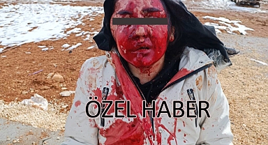 Gaziantep Adliyesi Önünde Kadına Şiddet: Eşinin Saldırısına Uğrayan Kadın Yoğun Bakımda